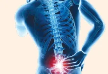 Weight Loss Cause Back Pain
